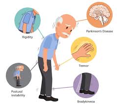 <p>Parkinsons disease</p>