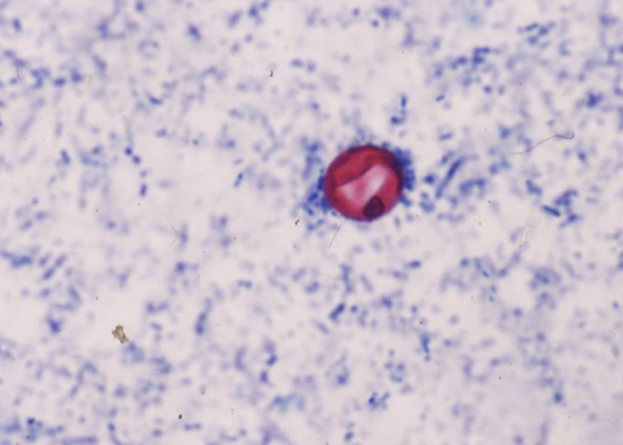 <p>What parasite is this?</p>