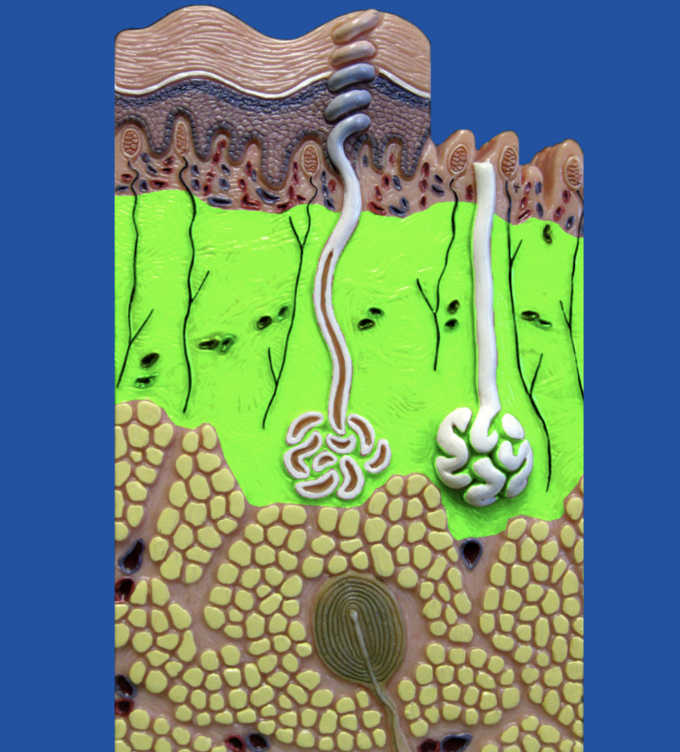 term image