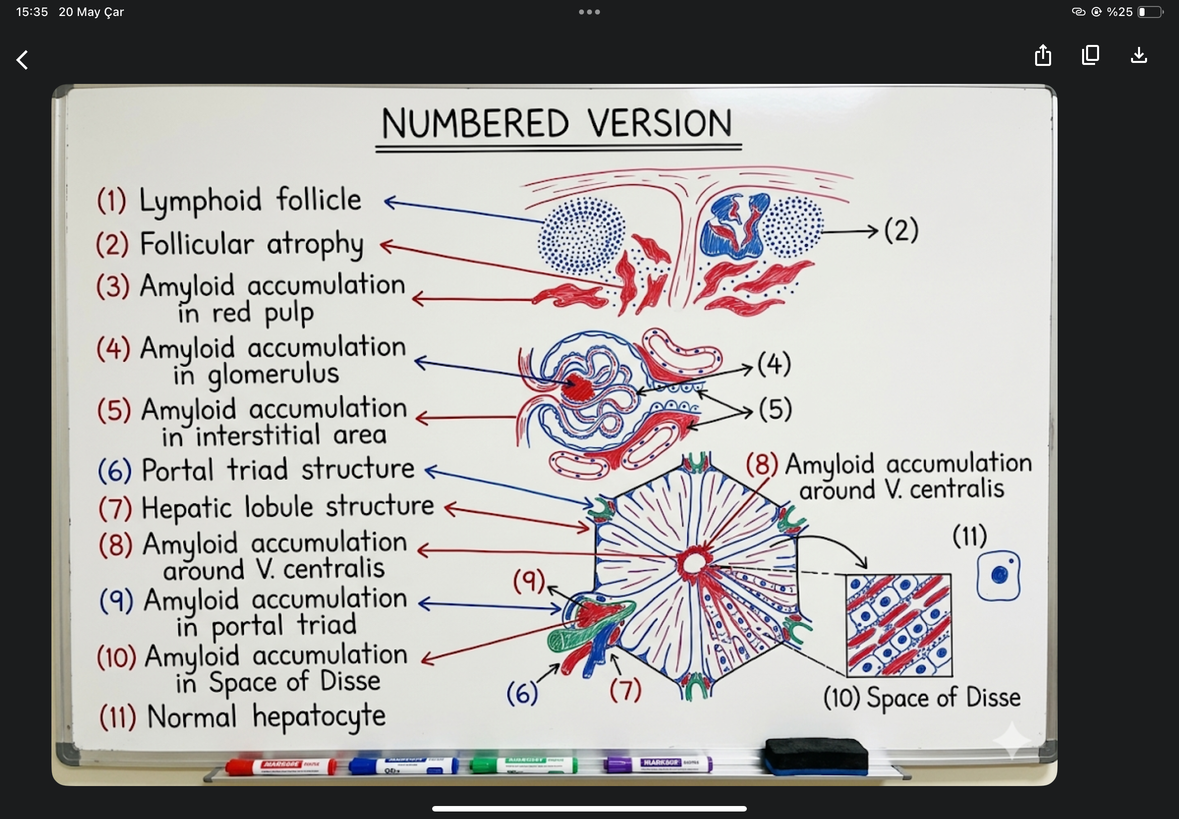 <p>amyloid accumulation, liver, spleen, kidney, rat</p>