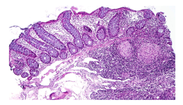 term image