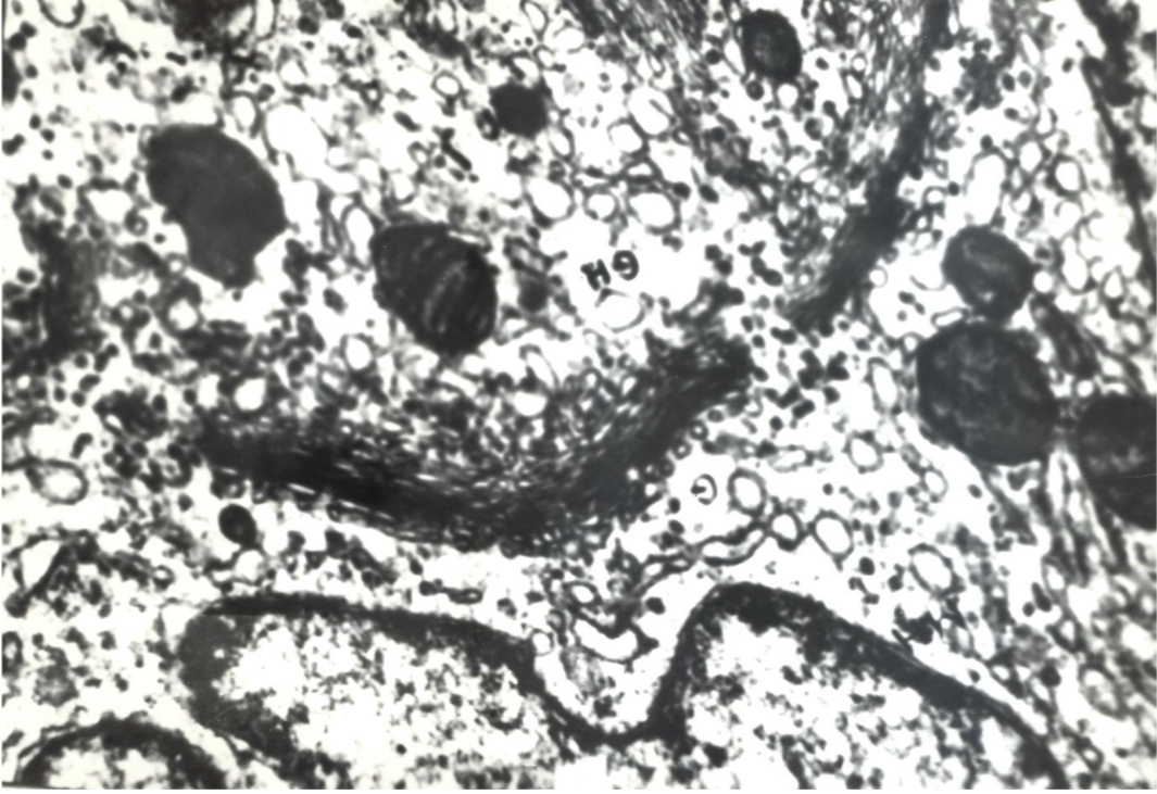 term image