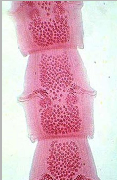 <p>Proglottids are barrel-shaped longer than wide double pore</p>