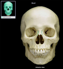 <p>What type of suture is shown?</p>