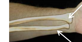 <p>What bone is this? What view of the bone is this?</p>