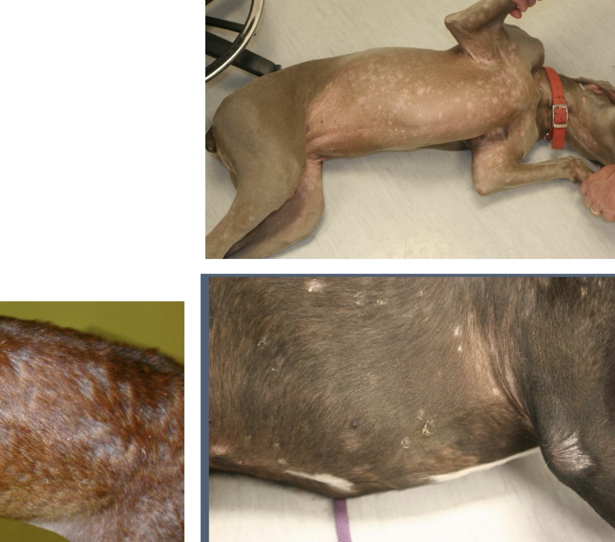 <p>Superficial Bacterial Folliculitis (SBF)</p>