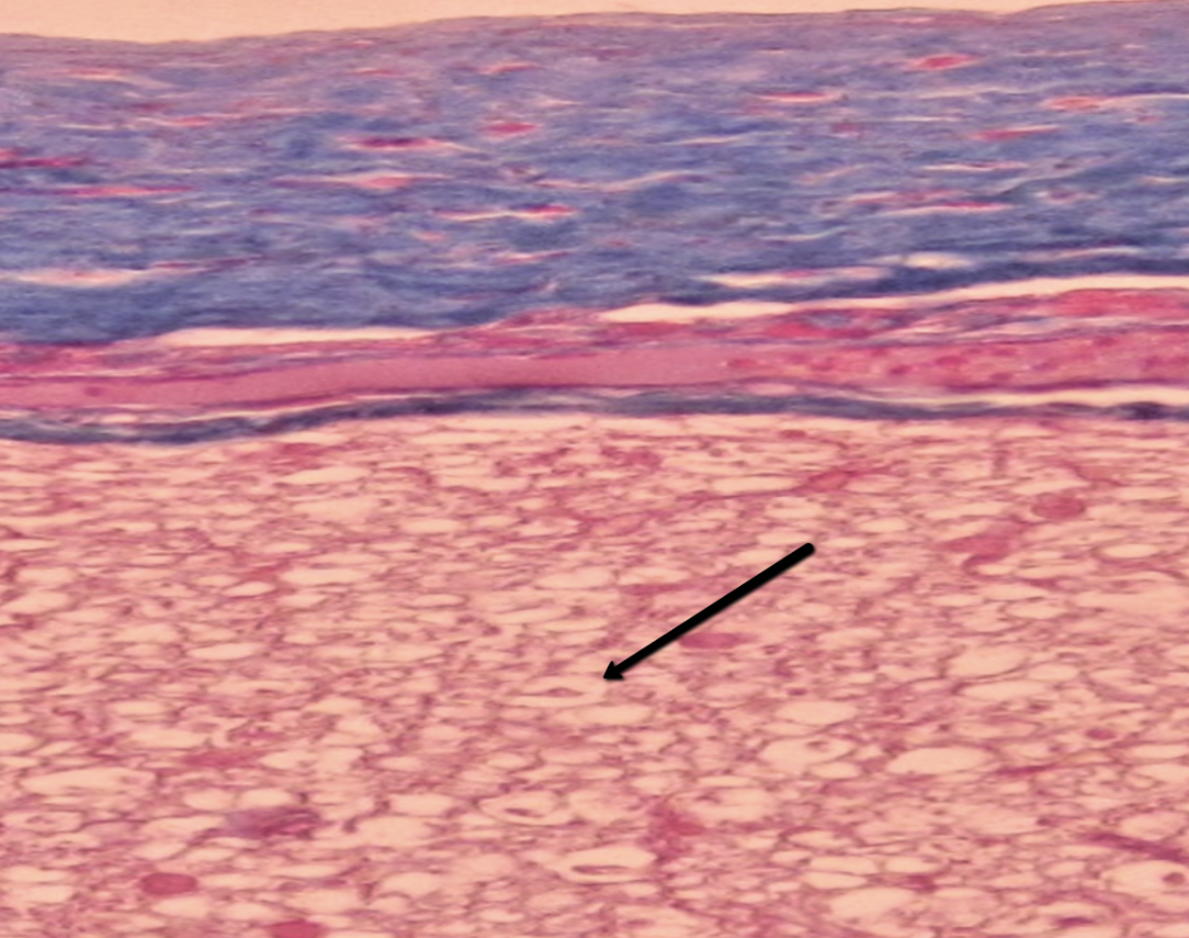 <p><span>Identify the white cell surrounding the small red dot indicated by the pointer.</span></p>