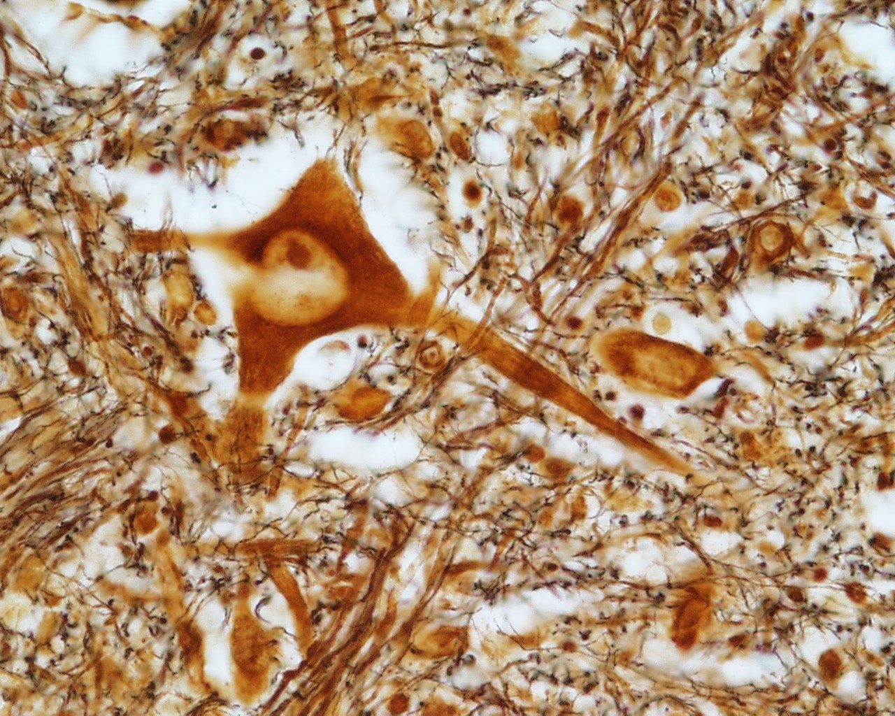 <p>Identifica la plaquita</p>