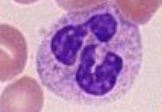 <p>What blood cell is this?</p>