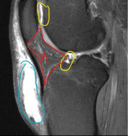 <p><strong>KNIE</strong></p><p>Quid?</p><ul><li><p>geel?</p></li><li><p>rood?</p></li><li><p>blauw?</p></li><li><p>beeldvorming?</p></li></ul><p></p>