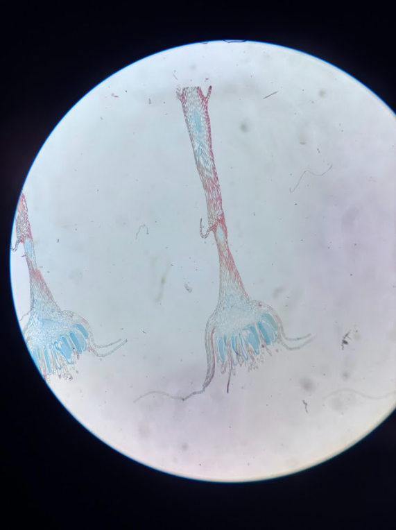 <ul><li><p><strong>Gametophyte</strong></p></li><li><p><strong>Haploid</strong></p></li><li><p>Large oval chambers</p></li><li><p>Filled with <strong>sperm</strong></p></li><li><p>Located at tips of gametophyte</p></li></ul><p></p>