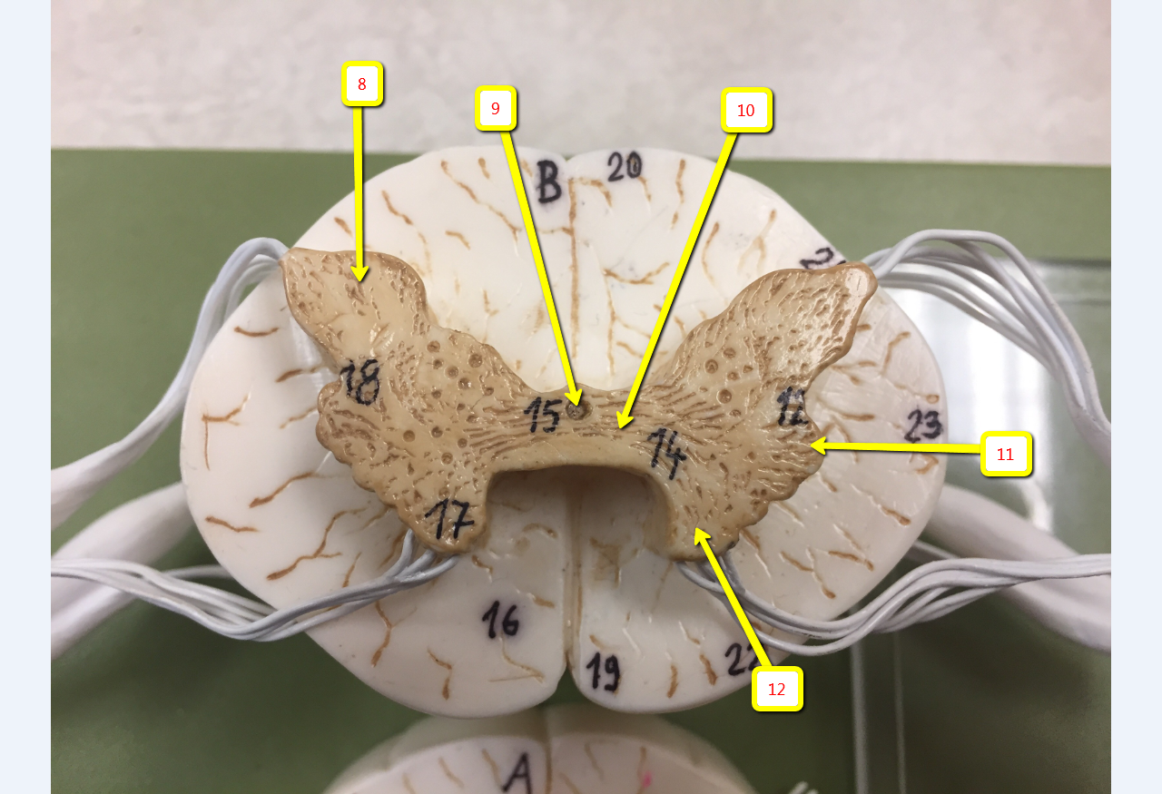<p><span>Name the specific area or structure indicated by arrow 11:</span></p>