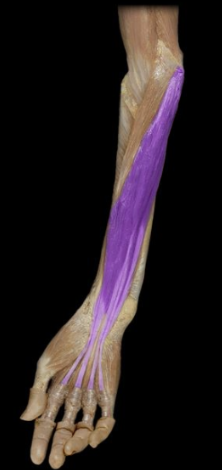<p>What the highlighted structure is acting on the <strong><mark data-color="#ffdb9c" style="background-color: rgb(255, 219, 156); color: inherit;">Wrist and Hands</mark>.</strong> What muscle is this called?</p>