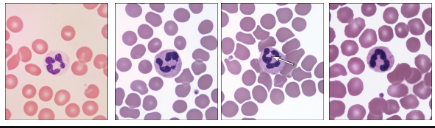 <ul><li><p>Granulocytes—<strong>neutrophils</strong></p><ul><li><p>Most abundant leukocytes (60–70% of total)</p></li><li><p>Slightly larger than RBCs</p></li><li><p>Multilobed nucleus</p></li><li><p>Small unstained or slightly lavender granules upon staining with Wright’s or Giemsa stains</p></li><li><p>Functionally short-lived phagocytic cells</p></li></ul></li></ul><p></p>