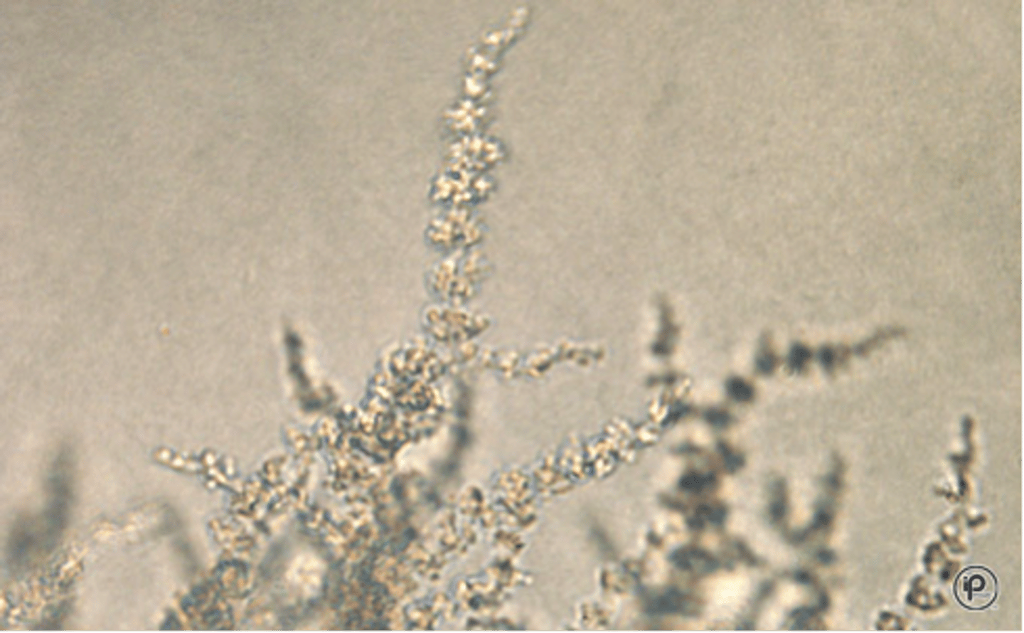 <p>Few, short pseudohyphae with small clusters of blastoconidia at the constrictions</p>