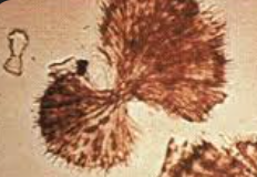 <p>Yellow/brown, Fan-shaped bow-ties</p><p>Abnormal, Drug-associated</p>