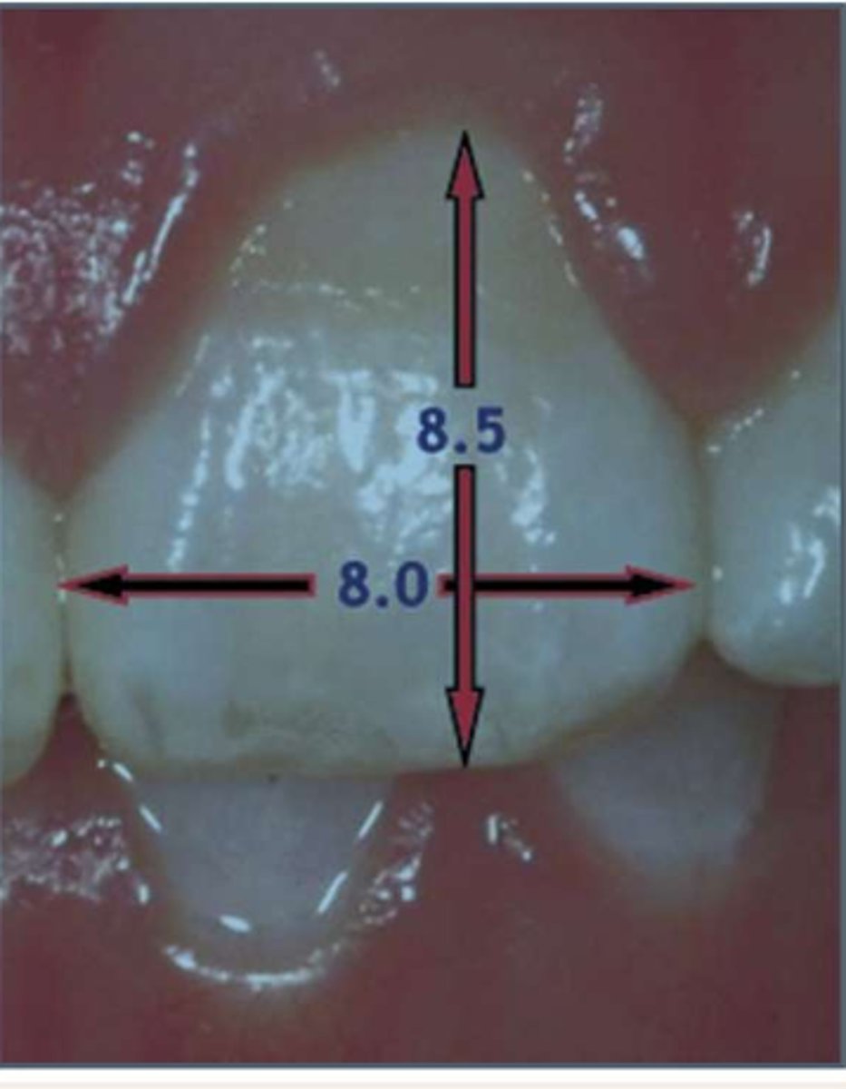 <p>Is this upper left central incisor too short or too wide?</p>