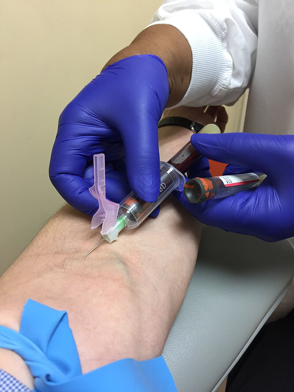 <p>antecubital</p>