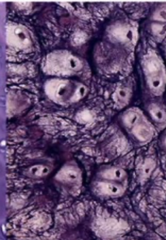 <p>What type of cartilage?</p>