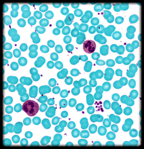 <p>Erythrocyte <span>(Blood Peripheral Smear)</span></p>