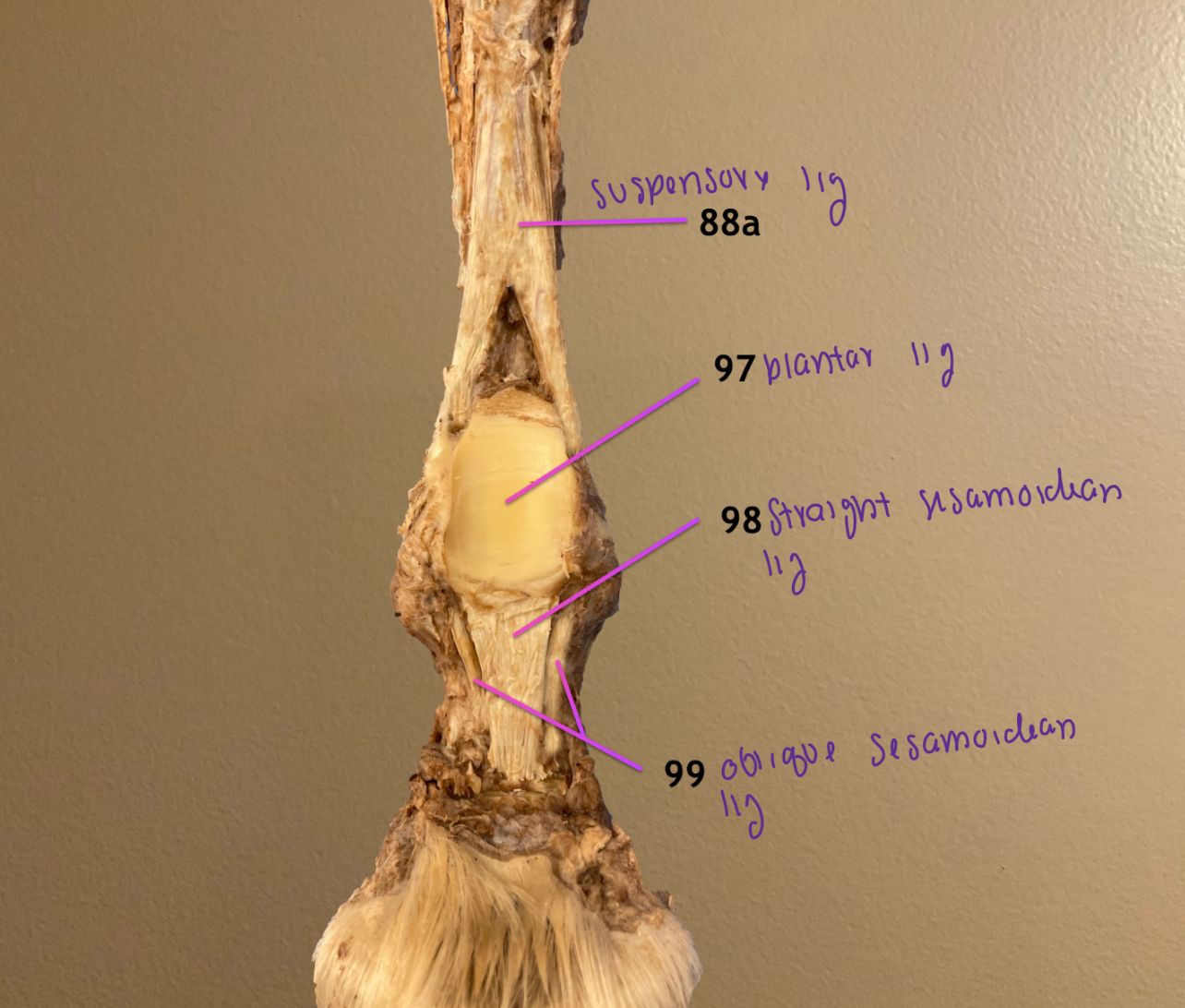<p>88a: suspensory ligament</p><ol start="97"><li><p>plantar ligament</p></li><li><p>straight sesamoidean ligament</p></li><li><p>oblique sesamoidean ligament</p></li></ol><p></p>