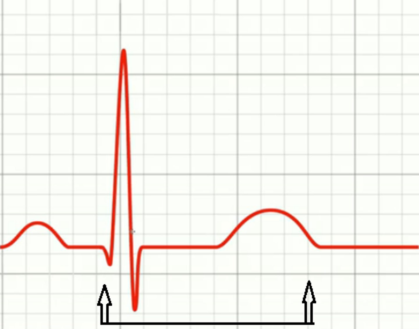 <p>time pushing; entire duration of ventricular depolarization + ventricular repolarization; aka ventricular systole; time measured in seconds</p>