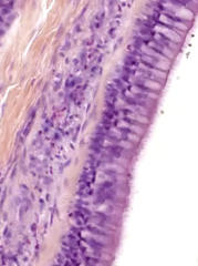 <p>apical specialization?</p>