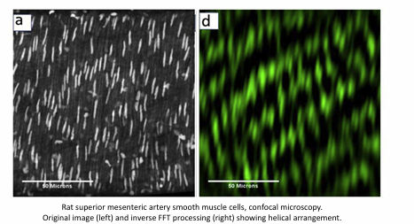 <p>Although the orientation and distribution of the medial constituents vary, vascular smooth muscle tends to be oriented helically, albeit nearly circumferentially in many vessels.</p><p>This preferential orientation is due to the primary role of SMC to contract and thus modify the distensibility of the large arteries or regulate the luminal diameter in medium and small arteries</p>