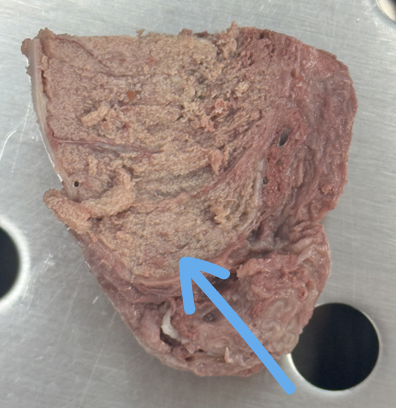 <p>seminiferous tubule</p>