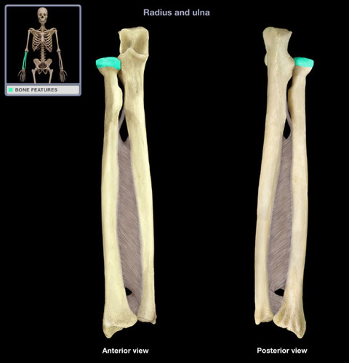 <p>- Articulates with capitulum of humerus</p>