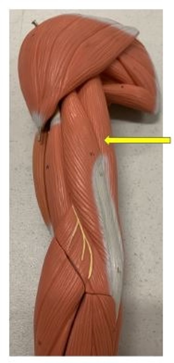<p>O: infraglenoid tubercle</p>