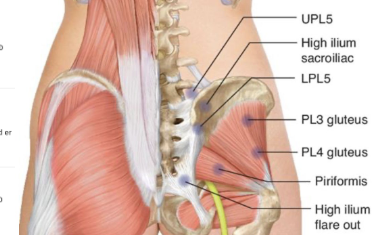 <p>posterior pelvic CS points?</p>