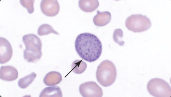 <p>what type of inclusion is this?</p>