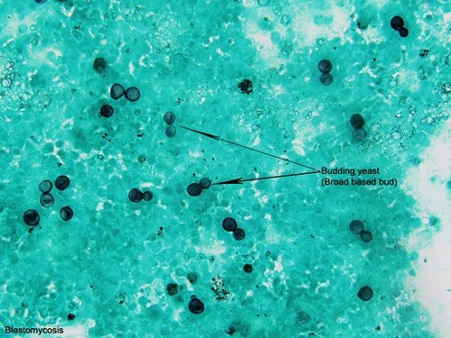 <p>fungi (eg. Pneumocystis)</p>