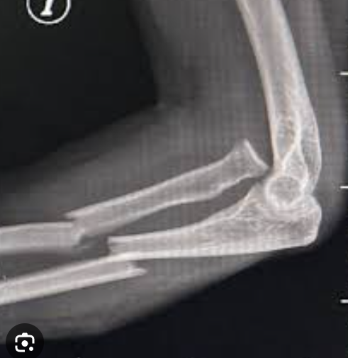 <p>bado 4 monteggia</p>