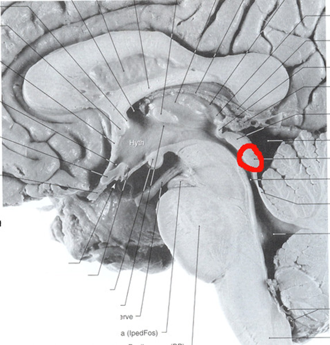 <p>inferior colliculus</p>