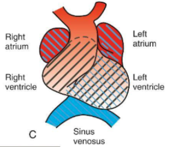 <p>S-Shaped Configuration</p>