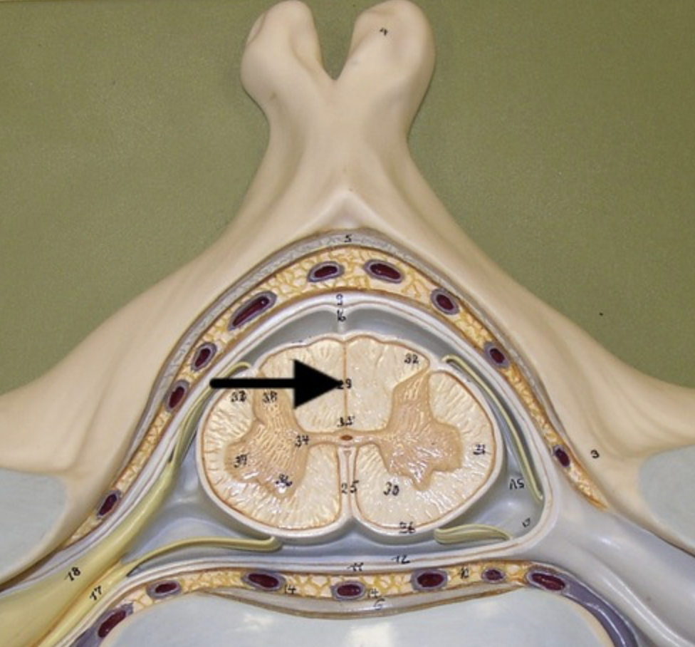 <p>shallow indentation along posterior midline of spinal cord</p>