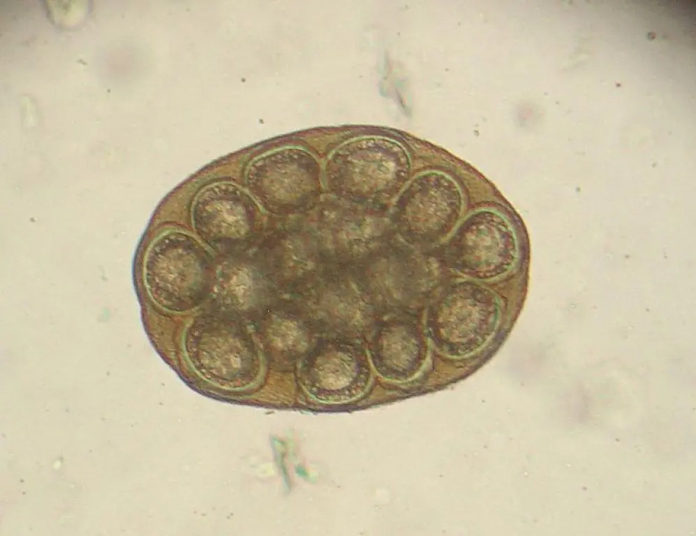 <p>Dipylidium caninum</p>