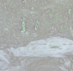 <p>Identify bone type(s)</p>