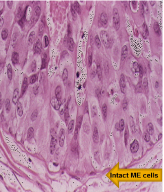 <p>What pathology?</p>