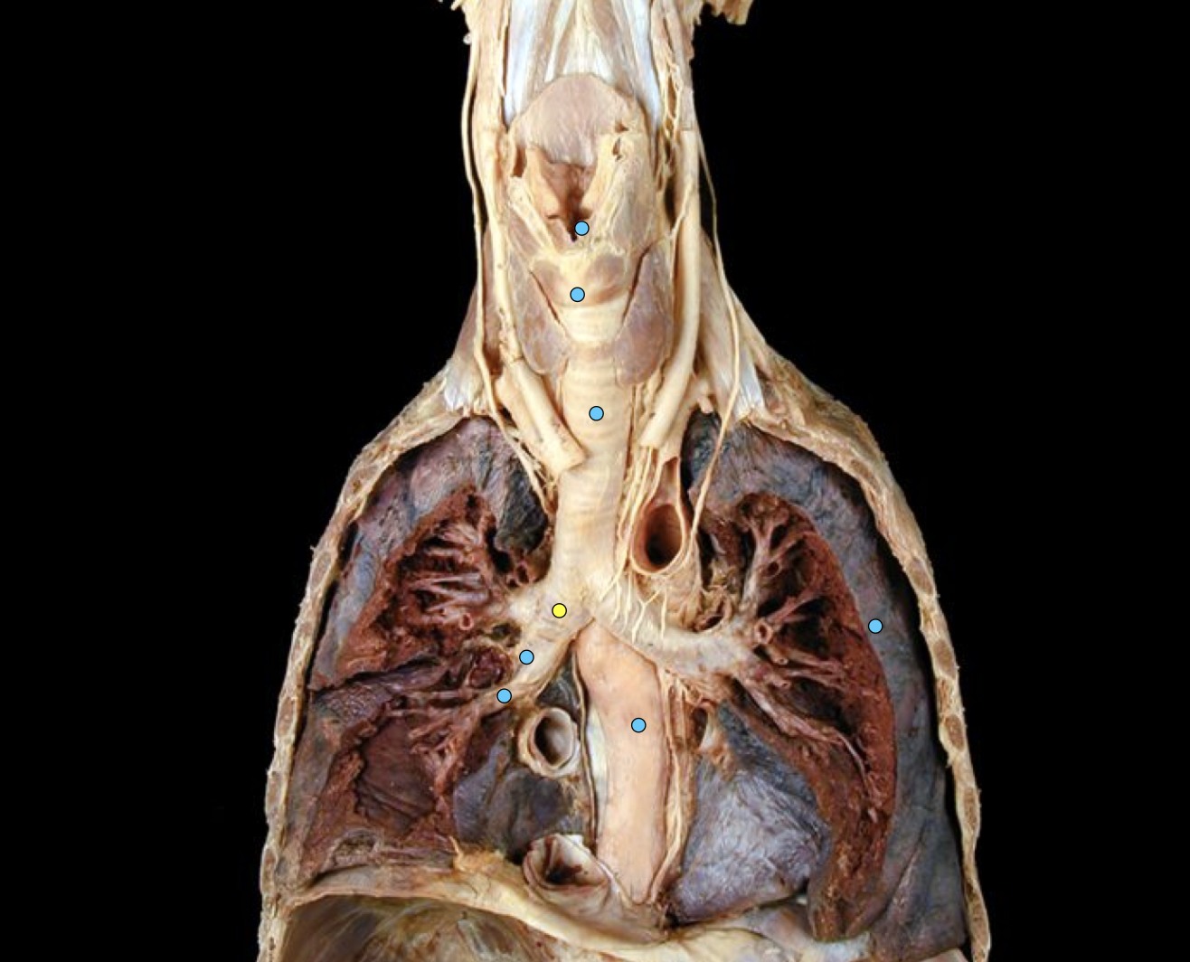 knowt flashcard image