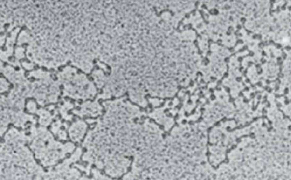 <p>Under a microscope, _______ looks like a diffuse, grainy, or thread-like mass in a standard light microscope, but high-powered electron microscopes reveal a detailed "beads on a string" structure</p>