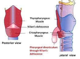 <p>-a triangular area in the posterior wall of the pharynx, located just above the upper oesophageal sphincter (in the same spot where zenker’s diverticulum)</p><p>-a potential weak spot where Zenker’s diverticulum is most likely to occur</p>