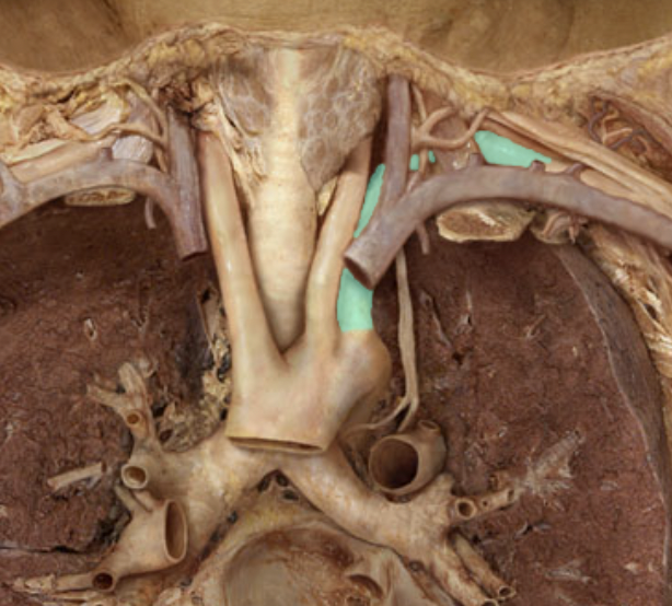 <p>Identify the feature of the arch of aorta</p>