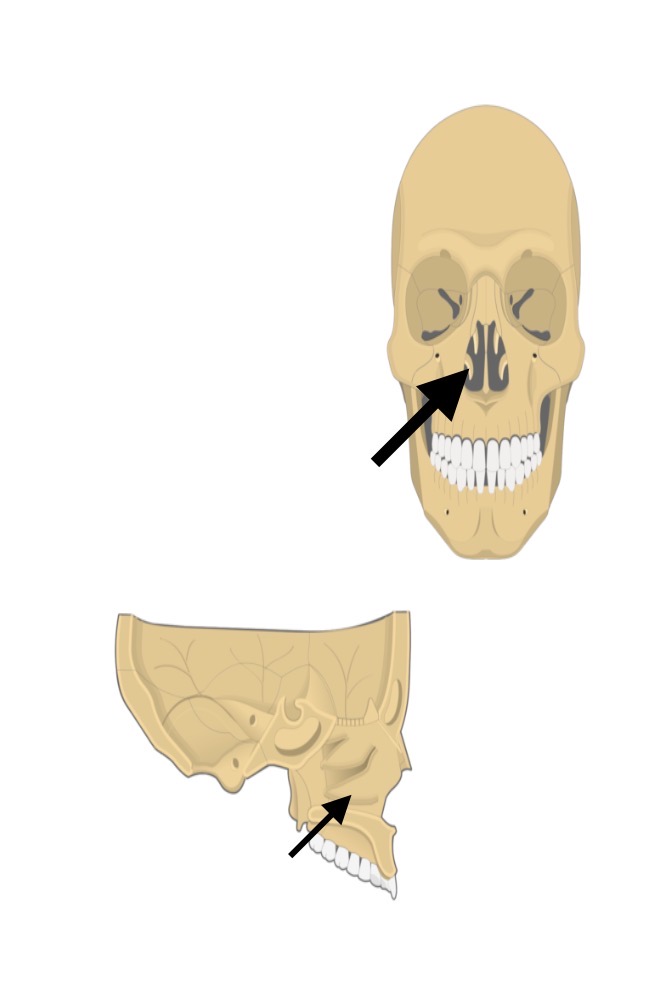 <p>Inferior nasal concha</p>