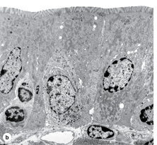 <p>What’s on the apical surface?</p>