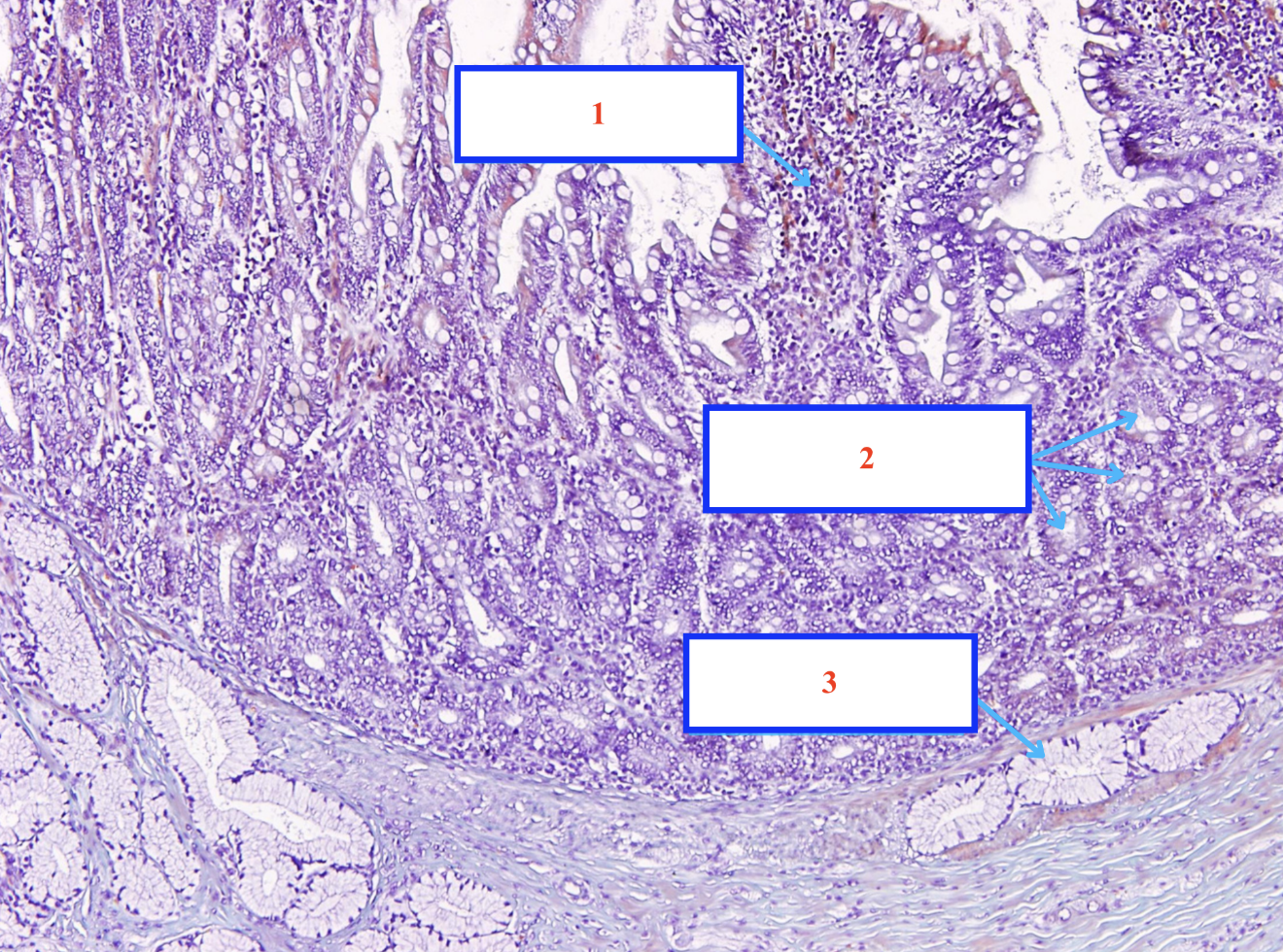 <p>Cấu trúc gì ? - Tiêu bản gì ?</p>