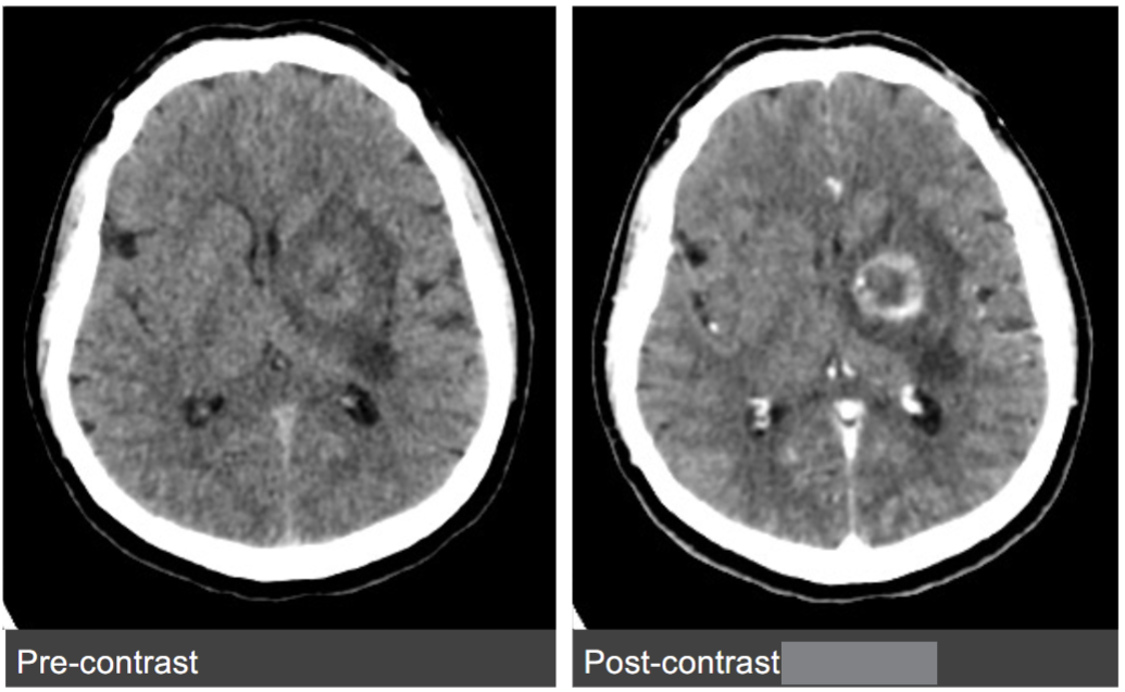 <p>Name the pathology </p>