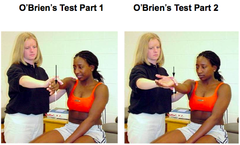 <p>tests for SLAP lesion</p>